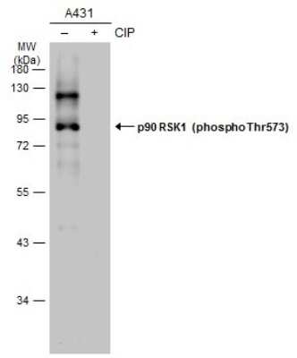 Western Blot: RSK1 [p Thr573] Antibody [NBP3-13271]